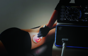 7 Secrets to achieving a natural bbl 3 Cryotshock leg 1