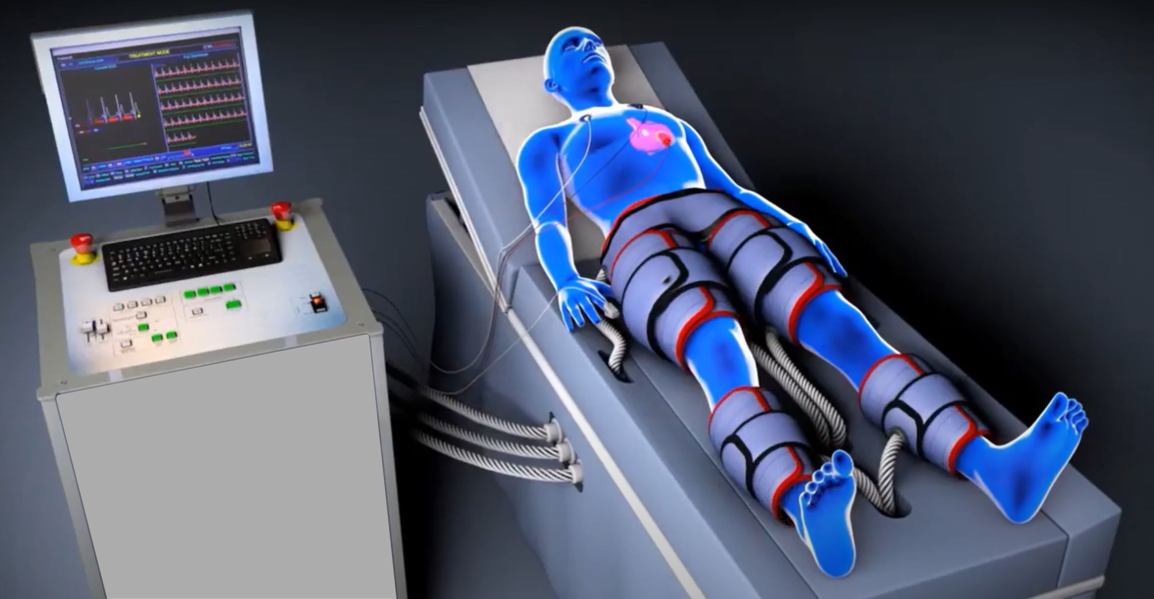 Athletic Benefits of EECP Therapy 1 EECP San Diego